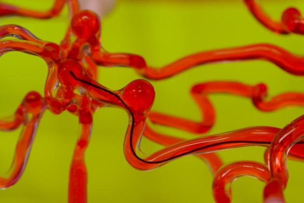 MIT’s new thread-like robots could travel through blood vessels in the brain for more effective surgery
