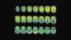 Why We Need Brain Scan Data Guidelines